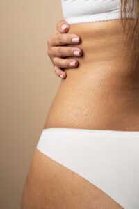 Laser CO2 Fracionado (Deka Smartxide DOT®, DUOglide®)