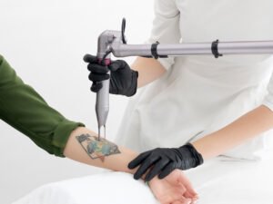Laser Sinon® Rubi