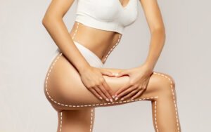 Radiofrequência (Power Shape®, Maximus TriLipo® RF)