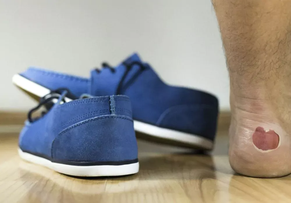 Como cuidar da pele dos pés para quem usa sapato fechado?