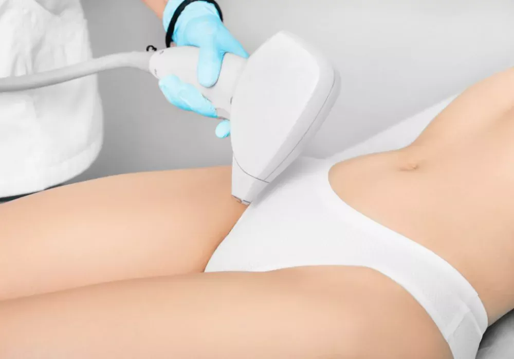 Depilação a laser na virilha: o que é e quais os benefícios?