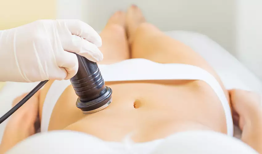 Lipocavitação: o que é e como funciona no tratamento da gordura localizada